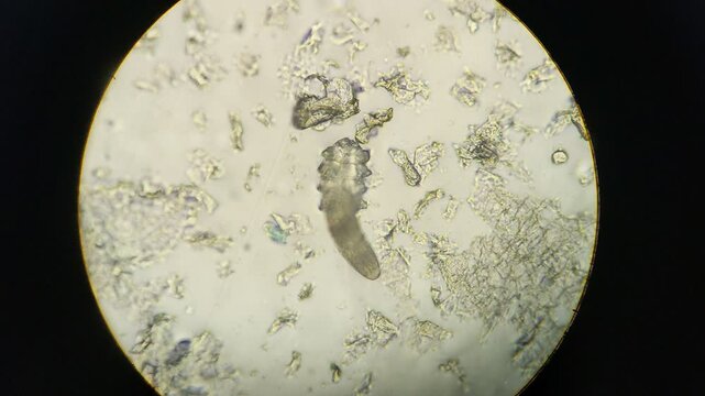 Footage of viable Demodex or face mites seen moving under the microscope