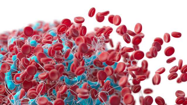 Blood clot, illustration