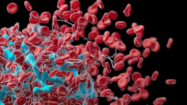 Blood clot, illustration