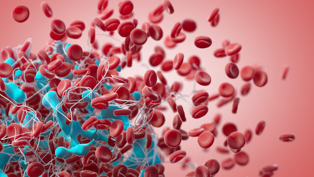 Blood clot, illustration