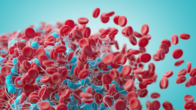Blood clot, illustration
