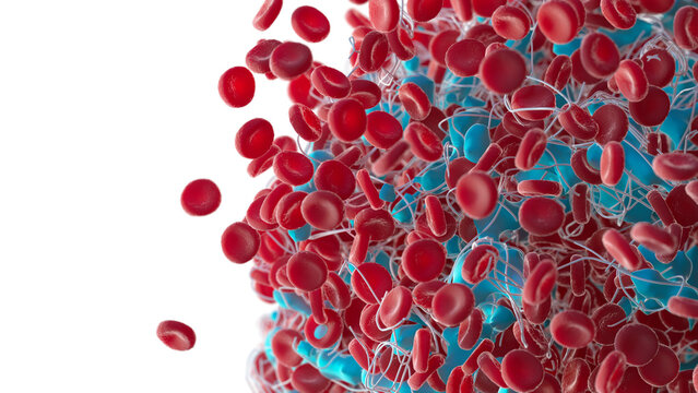 Blood clot, illustration