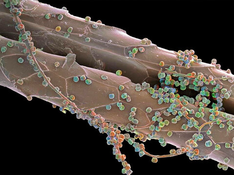 Fungal spores on hair, SEM