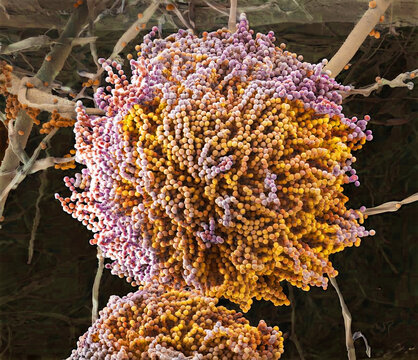 Aspergillus fungus, SEM