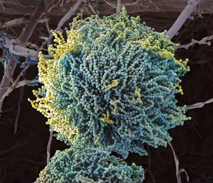 Aspergillus fungus, SEM