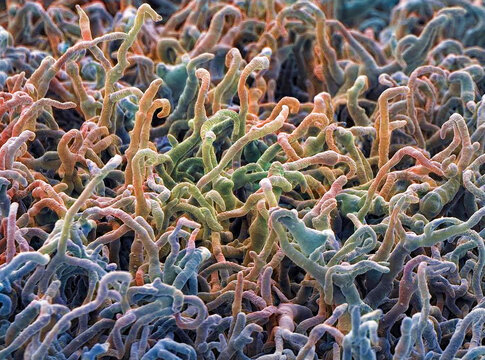 Fungal hyphae, SEM