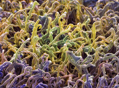 Fungal hyphae, SEM