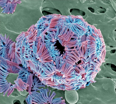 Coccolithophore, SEM