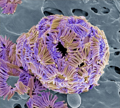 Coccolithophore, SEM