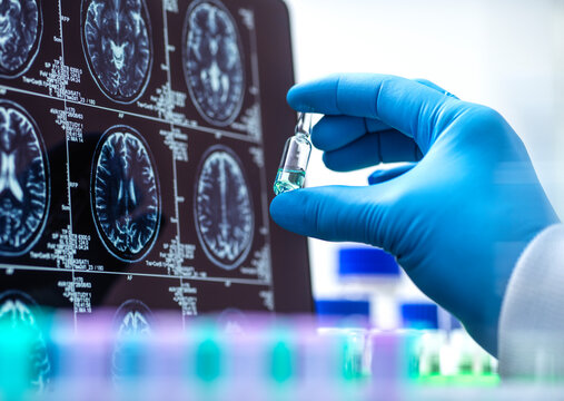 Scientist developing new medicine near MRI scan on screen