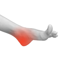 Foot pain and inflammation. Sore heel and joint injury causing chronic ache or neuropathy. Medical...