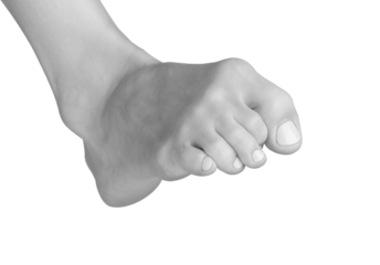 Gray foot with tense toes and ankle. Barefoot model showing inward posture, stress, and cramp. Smooth, clean skin for chiropody care. isolated on white background.