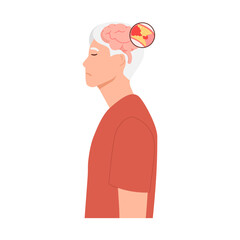 Man suffering from stroke. Ischemic stroke patient. brain with blood clot. blocked artery. Cerebral ischemia. Flat vector illustration