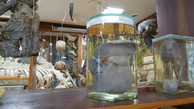 Human liver in glass flask. Major metabolic organ, which performs many essential biological functions such as detoxification of organism, and synthesis of proteins and biochemicals necessary