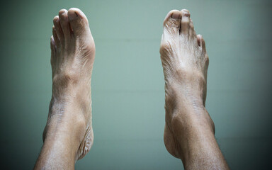Feet bare pose of an older person