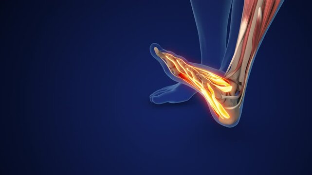 Plantar Fascia Providing Arch Support in Feet