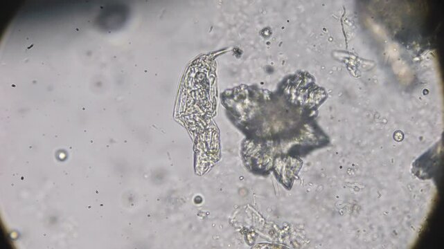 Rotifers observed under magnification, displaying movements and internal structures in water containing microorganisms and organic matter.