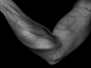 Infrared Photography at 850nm of a Man's Arm Revealing Veins Beneath His Skin
