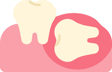 wisdom tooth removal remove discomfort pain oral dental care health