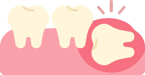 wisdom tooth removal remove discomfort pain oral dental care health