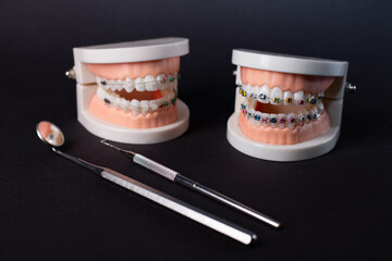 orthodontic model and dentist tool - demonstration teeth model of varities of orthodontic bracket...