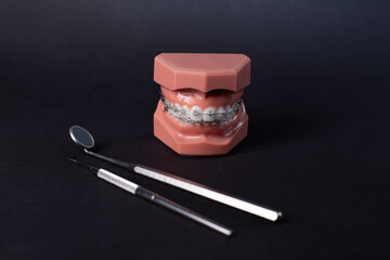 orthodontic model and dentist tool - demonstration teeth model of varities of orthodontic bracket or brace