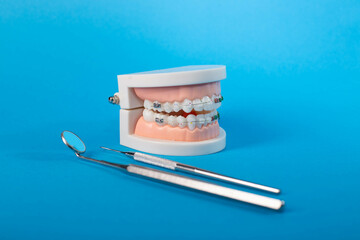 orthodontic model and dentist tool - demonstration teeth model of varities of orthodontic bracket...