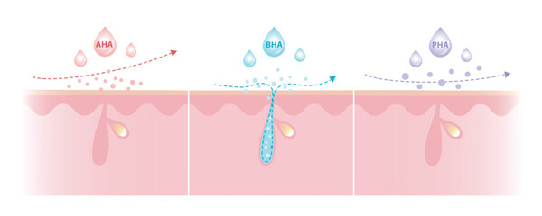 Comparison of Alpha, Beta, Poly Hydroxy Acids characteristics illustration. AHA exfoliate the surface skin. BHA penetrate deep into the pore. PHA dissolve the surface, large molecule, penetrate less.