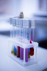tubes in laboratory with blurry background