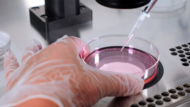 Close-up of IVF procedure. An embryologist wearing protective gloves drips the medium from plastic test tube into Petri dish.