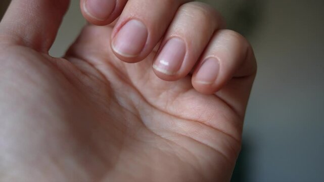 natural nails with well-groomed manicure. white spot on the nail plate, leukonychia