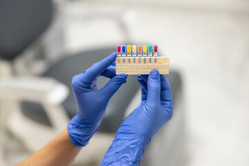 Close-up of a dental professional's gloved hands holding dental color matching tools, used for...