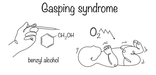 Gasping syndrome