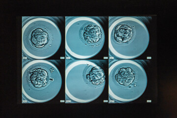 Microscopic View of Cellular Development of a Cell in a Laboratory Setting Displayed in a Grid Pattern
