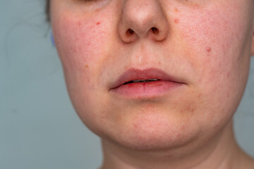 Close up portrait of a woman. Beauty and skin problems concept. High quality photo