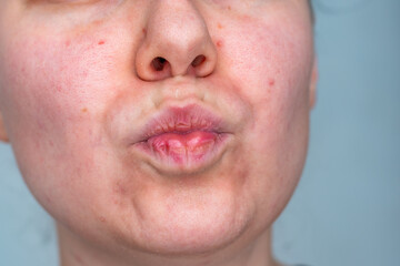 Naklejka premium Close up portrait of a woman. Beauty and skin problems concept. High quality photo