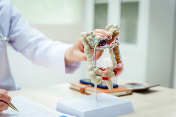 A male doctor wearing glasses sits at a desk, explaining an intestinal model, discussing anatomy, small and large intestine functions, colitis, colon cancer, appendicitis symptoms,digestive health