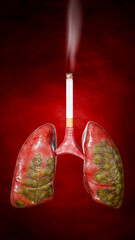 Lung cancer. Noncommunicable diseases or NCDs. Lung infections spread due to inhalation of cigarette smoke or dust. 3D Rendering