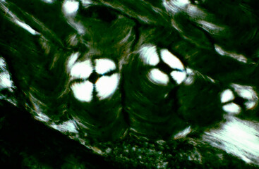 Osteon. Polarized light