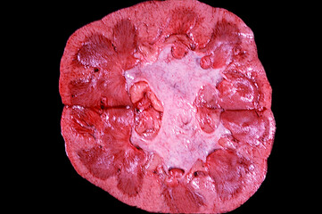 Human kidney