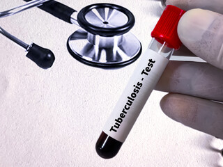 Blood sample for Tuberculosis test. Isolated on white background with copy space. MTB