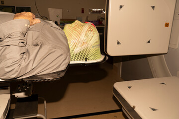 Senior male with skin cancer receiving radiation in a radiotherapy thermoplastic mask which...