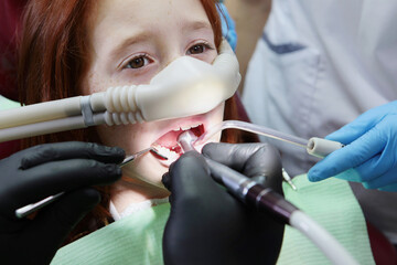 Dental treatment in child with sedation. Little girl is injected with an inhalation sedative during...