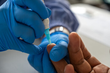 Medical professional performing blood sampling with a lancet on a patient's finger, wearing blue...