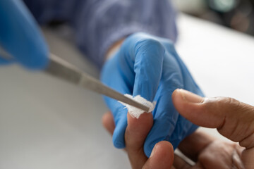 The nurse's or doctor's hand applies gauze or wound dressing using pitset tweezers to the patient's...