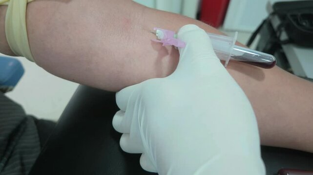 Venipuncture to obtain a blood sample in a tube with a purple cap.