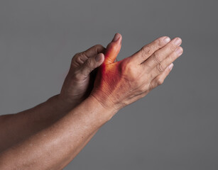 Woman in her 70s suffering from pain in hands and fingers, arthritis inflammation. Red highlight