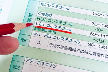 健康診断結果のLDLコレステロールの値