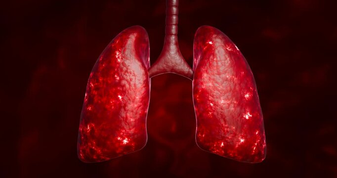 Lung cancer. Noncommunicable diseases or NCDs. Lung infections spread due to inhalation of cigarette smoke or dust. 3D Rendering