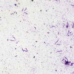 Crimson red spirochetes is a spiral shaped bacterium that is Gram negative and generally undergoes anaerobic phototrophic living.Magnify 400x
